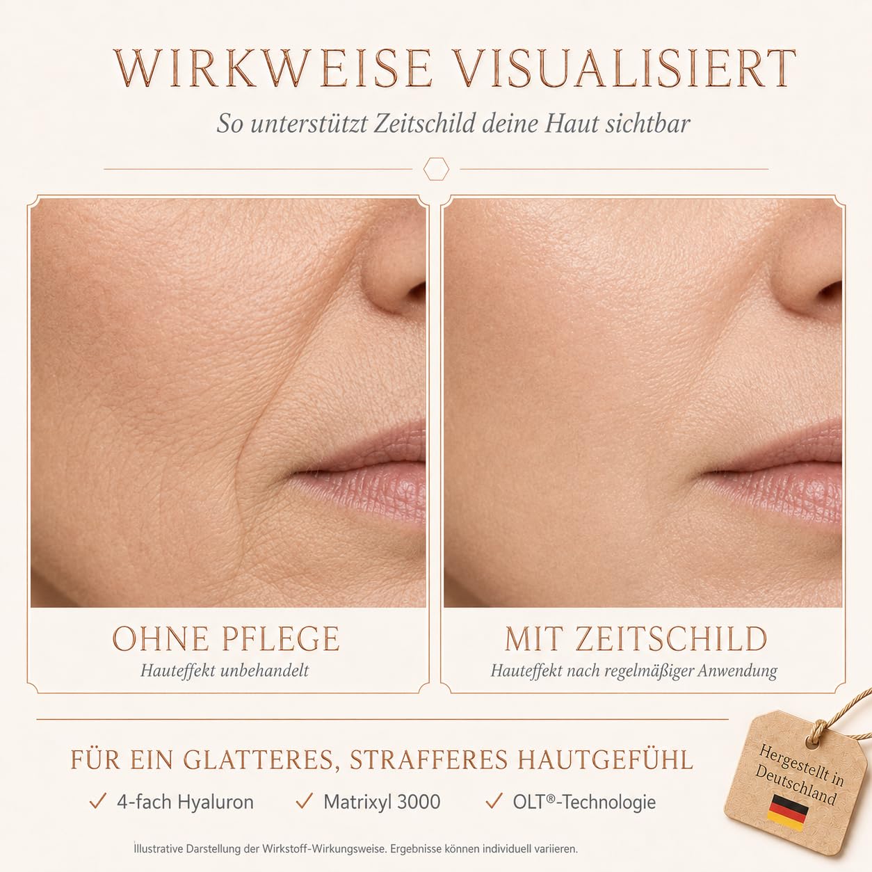 Anti Falten Serum Hochdosiert mit 4-fach Hyaluronsäure Matrixyl 3000 & OLT® - Anti-Aging Hyaluron Gesichtsserum gegen Tiefenfalten - Reife Haut Frauen Männer 30ml Made in Germany