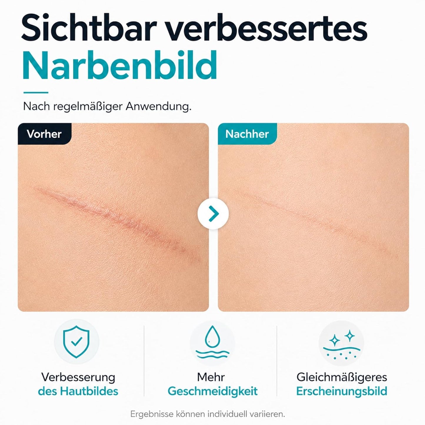 ZEITSCHILD Narbencreme Regeneration