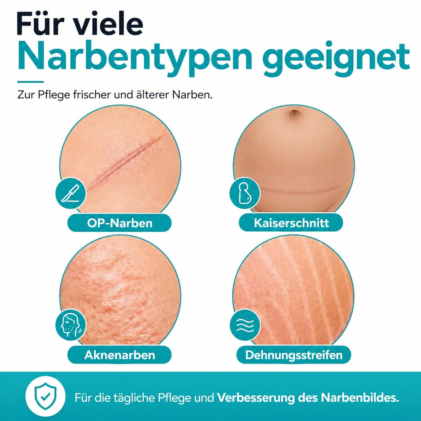 ZEITSCHILD Narbencreme Regeneration