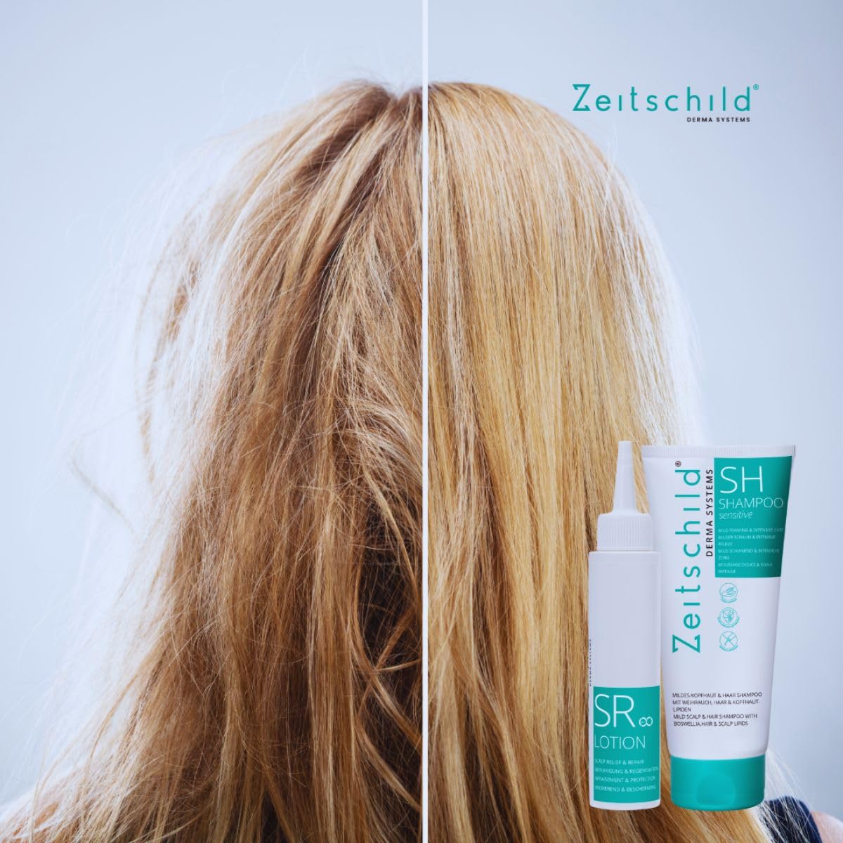 Kopfhaut Pflege - Intensiv – Bei Juckreiz, Trockenheit & Schuppen – mit Niacinamid (Vitamin B3) – parfumfrei, leichte Lotion, Scalp Repair & Relief Lotion 90 ml